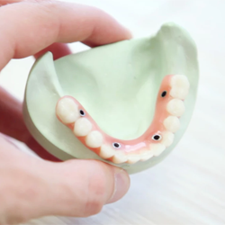 Dentures