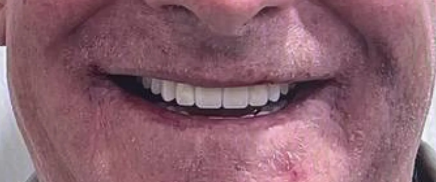 After view of dental treatment by Dr. Desmond Ng