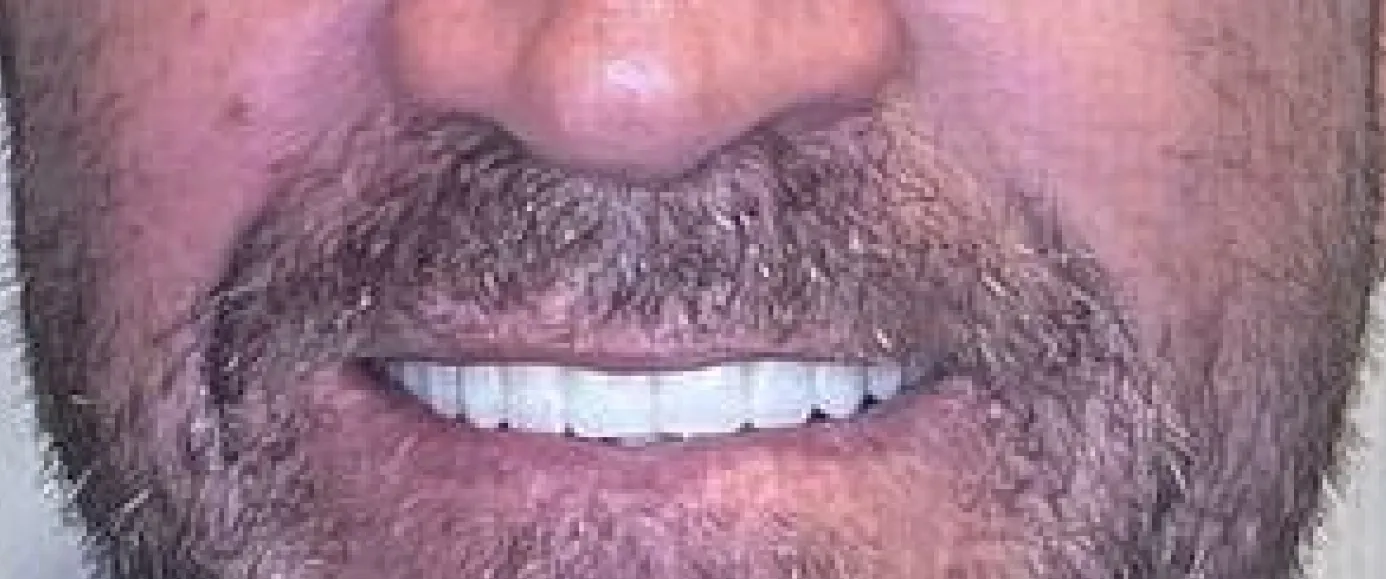 After view of dental treatment by Dr. Desmond Ng