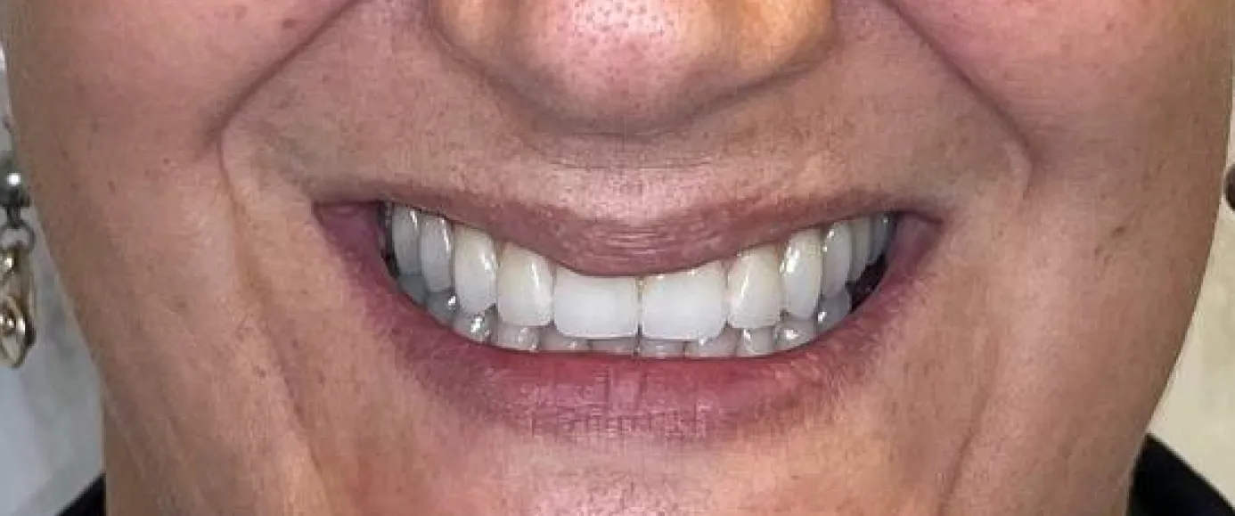 After view of dental treatment by Dr. Desmond Ng