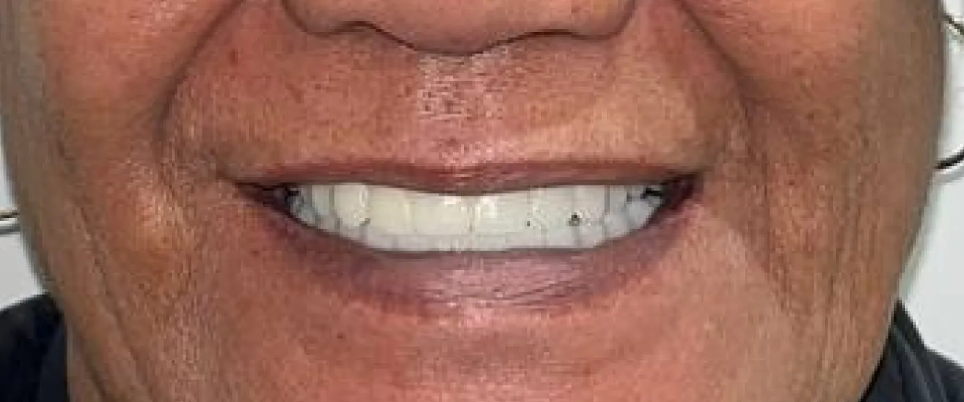 After view of dental treatment by Dr. Desmond Ng