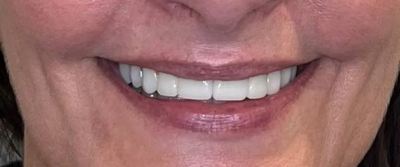 After view of dental treatment by Dr. Desmond Ng