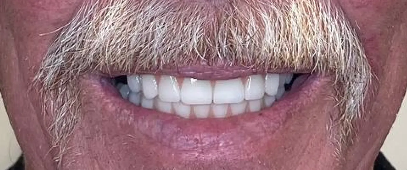 After view of dental treatment by Dr. Desmond Ng