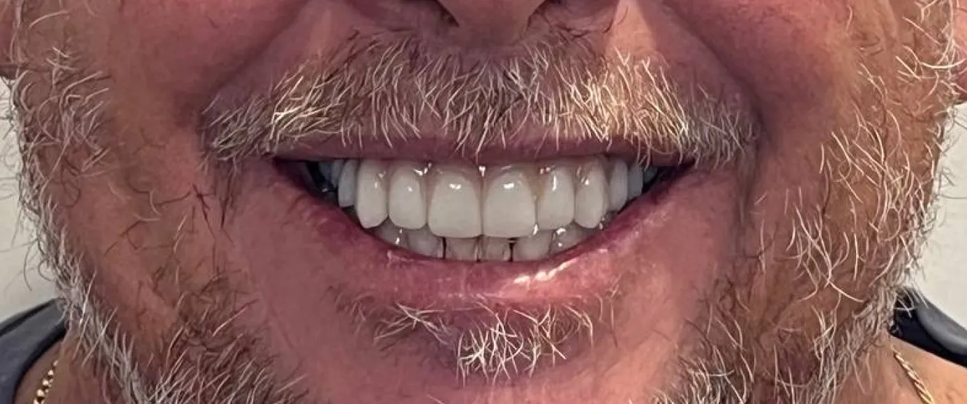 After view of dental treatment by Dr. Desmond Ng