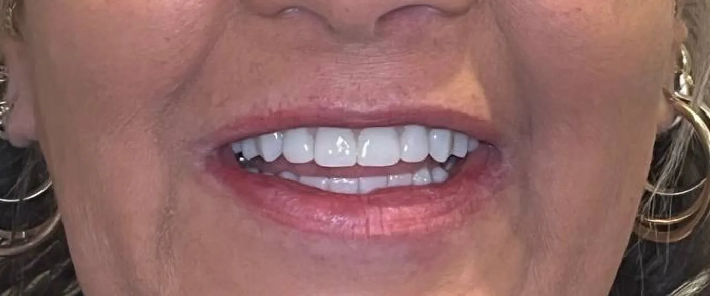 After view of dental treatment by Dr. Desmond Ng