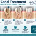 What Is a Root Canal Treatment?